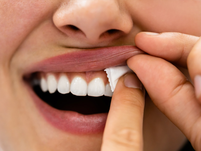 donna posiziona qualcosa tra labbro e gengiva